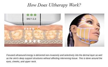 Máquina enfocada de intensidad alta de la belleza del ultrasonido HIFU para el tratamiento de la cara en salón de belleza