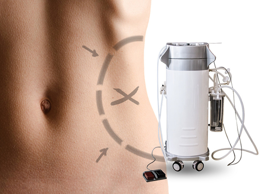 Máquina quirúrgica estética del Liposuction para la succión quirúrgica del abdomen/del brazo superior que adelgaza la máquina