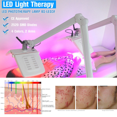 BIO LED máquina 10 de la terapia de la luz del favorable fotón - tratamiento del acné de la frecuencia 110HZ