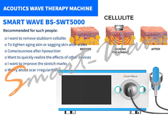 Máquina de la terapia de la onda acústica de 6 transmisores para el retiro de las marcas de estiramiento/la nueva formación del cuerpo