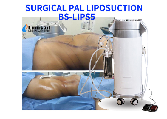 Máquina quirúrgica ultrasónica del Liposuction de PAL que adelgaza el equipo de la belleza con el sistema de la cánula