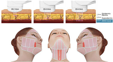 Invasor no- de la máquina del removedor de la arruga de la cara de la elevación de la piel del dispositivo de la belleza de HIFU