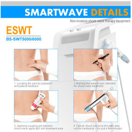 Achillodynia/máquina plantar ESWT de la terapia de la onda de choque de Fasciitis ESWT