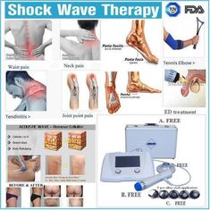 Alta máquina de la terapia de la onda de choque del tratamiento ESWT del resultado del efecto para el tratamiento de las fracturas de tensión