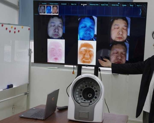 20 analizador facial de la piel de los pixeles de la piel de prueba del espectro mega de la máquina 6