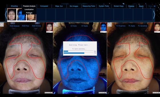 Máquina de la prueba de la edad de la piel de 8800 iluminaciones/máquina del cuidado de la cara con la luz ISO9001 del RGB