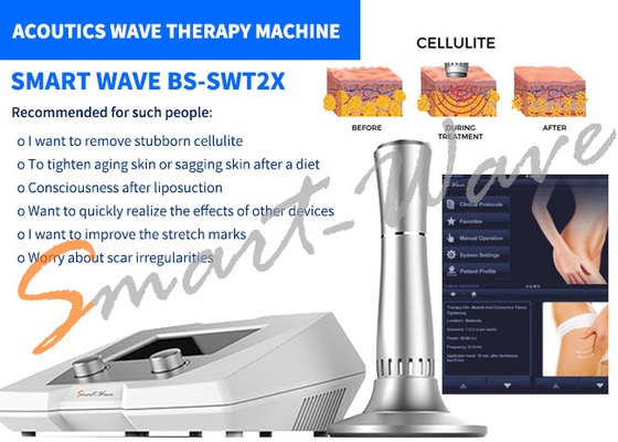 Retiro de las celulitis de la máquina de la terapia de la onda acústica del salón de belleza BS-SWT2X garantía de 1 año